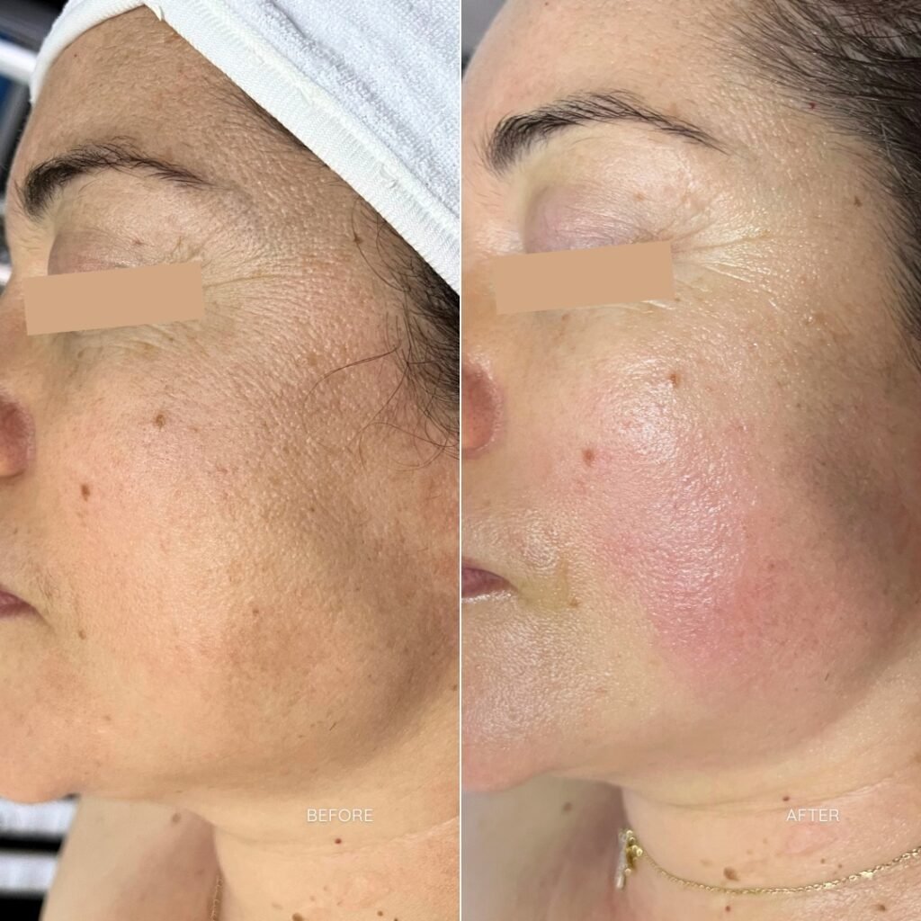 B&A1