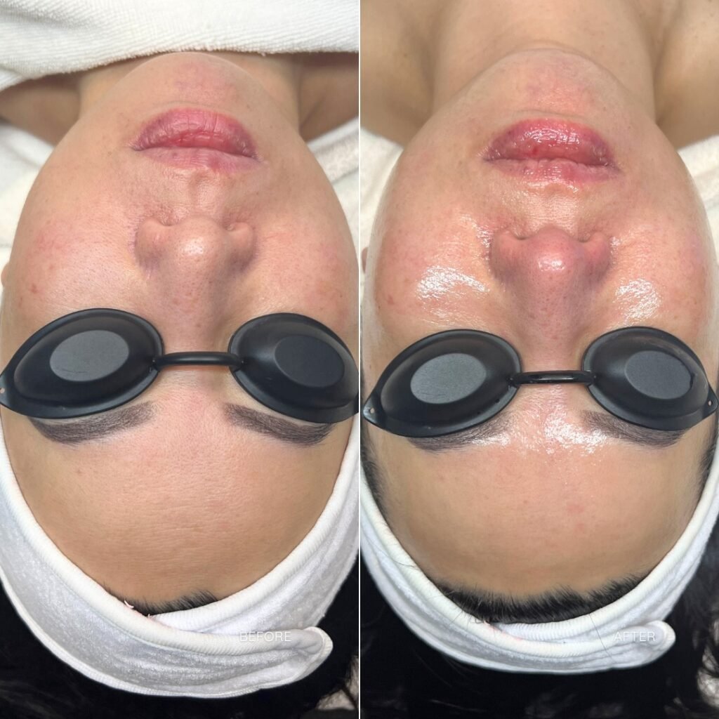 B&A2