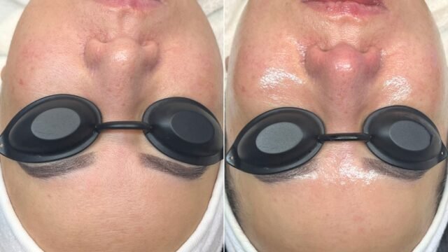 B&A2