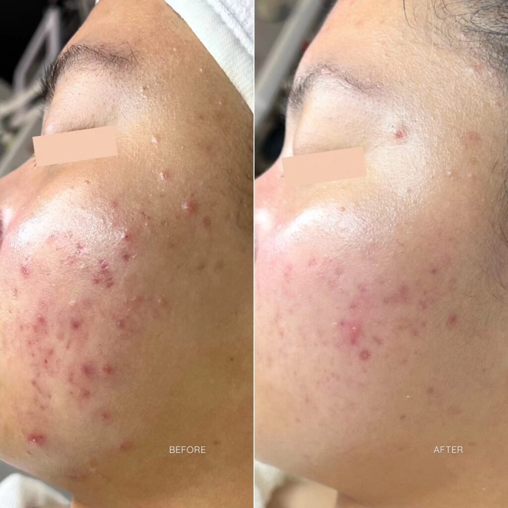 B&A3