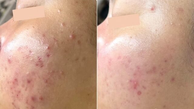 B&A3