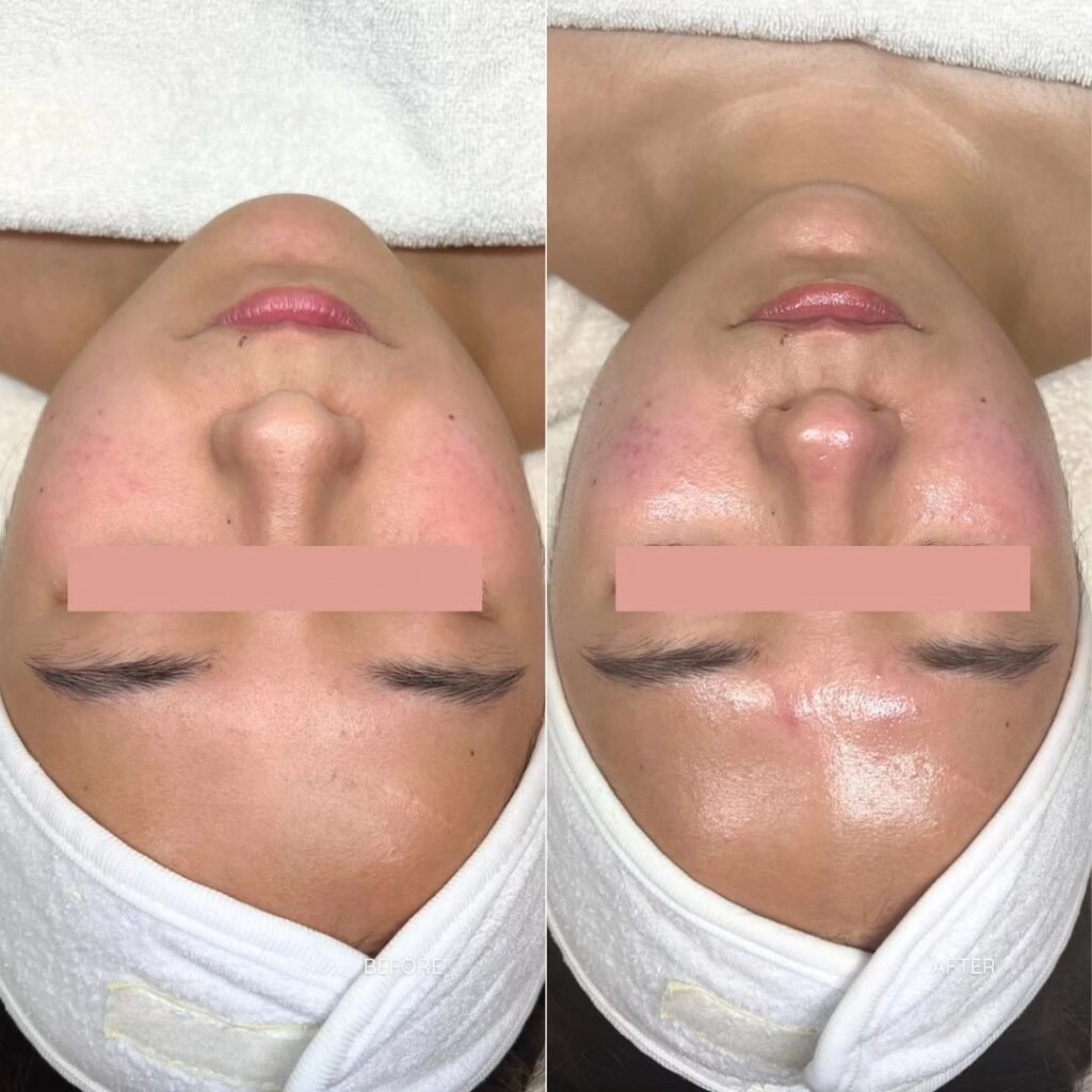 B&A4