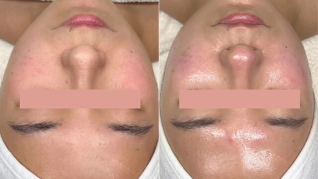 B&A4