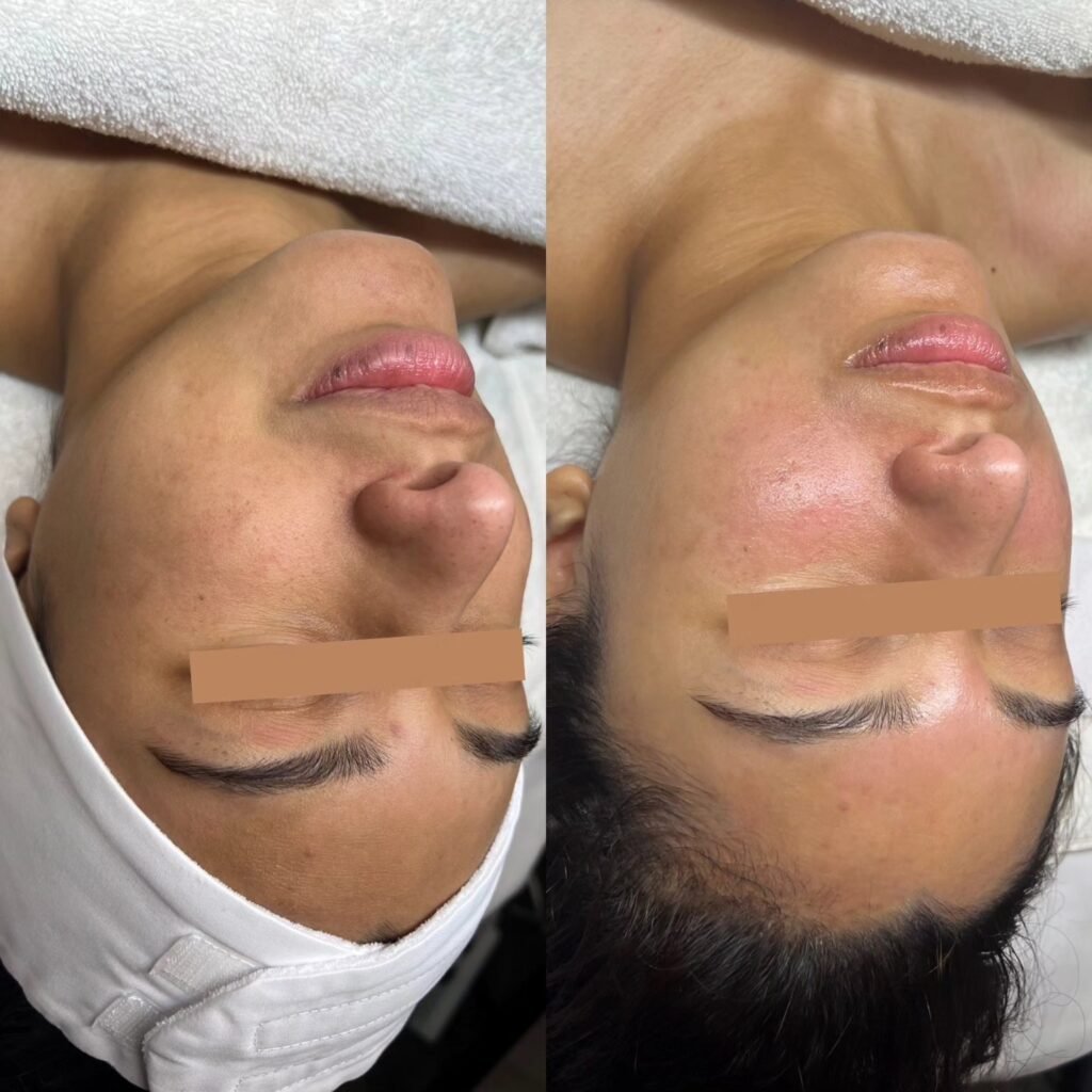 B&A5