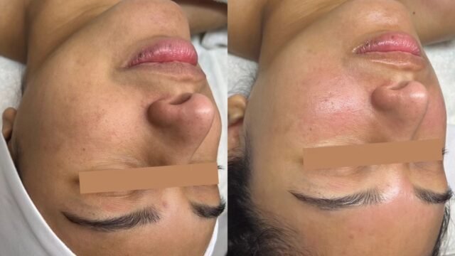 B&A5