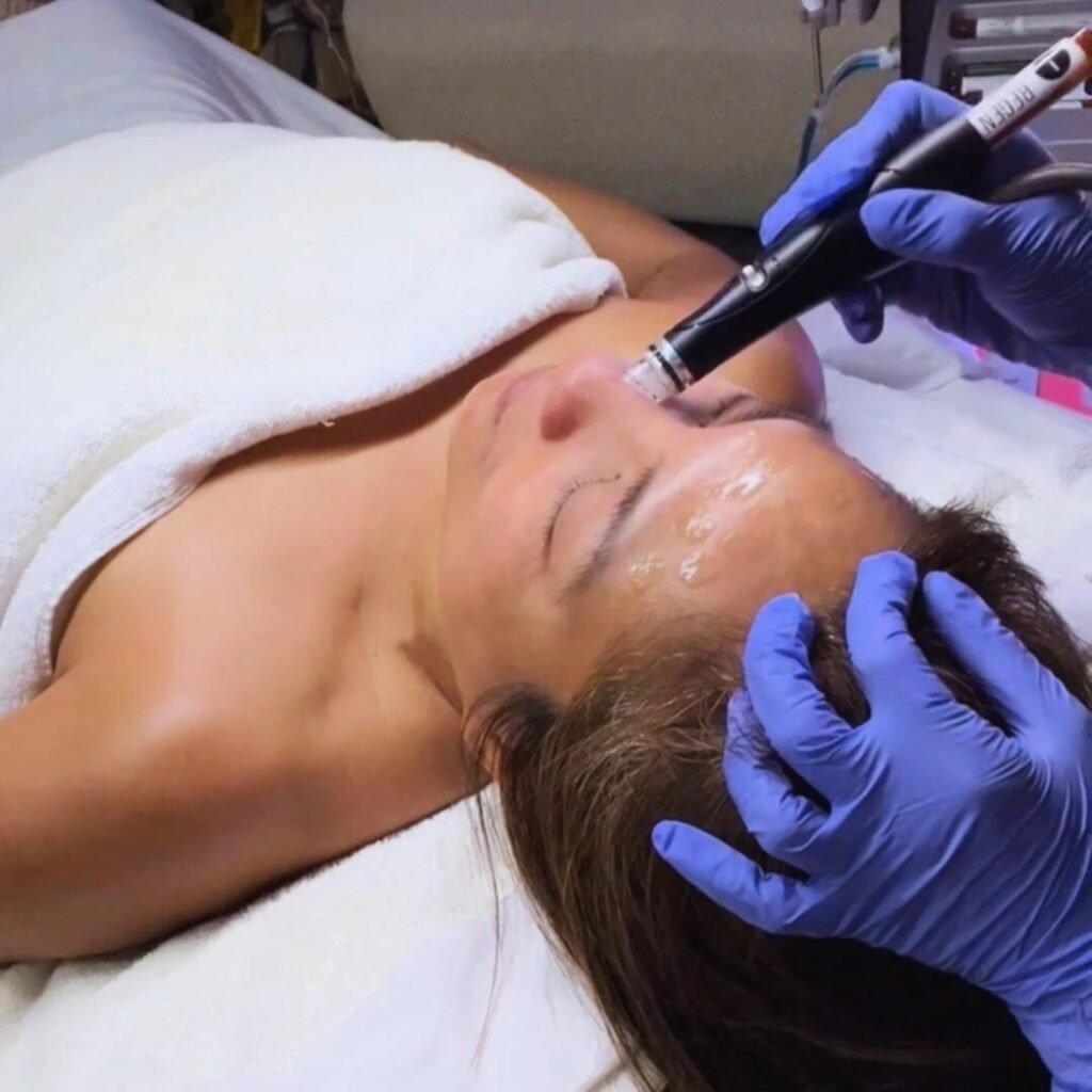 sfehelenhydrafacial1