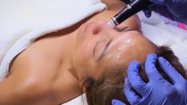 sfehelenhydrafacial1